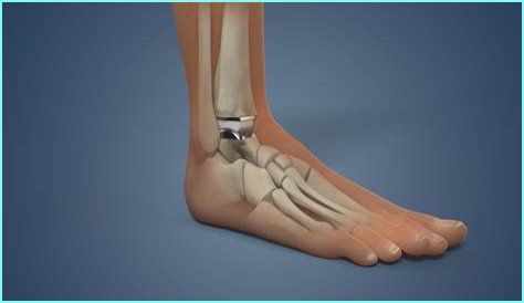 How Brock Bowers made a remarkable comeback from ankle surgery